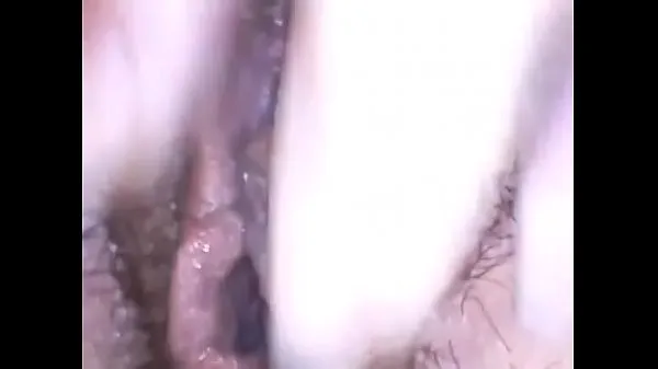 HD-Exploring a beautiful hairy pussy with medical endoscope have fun topvideo's